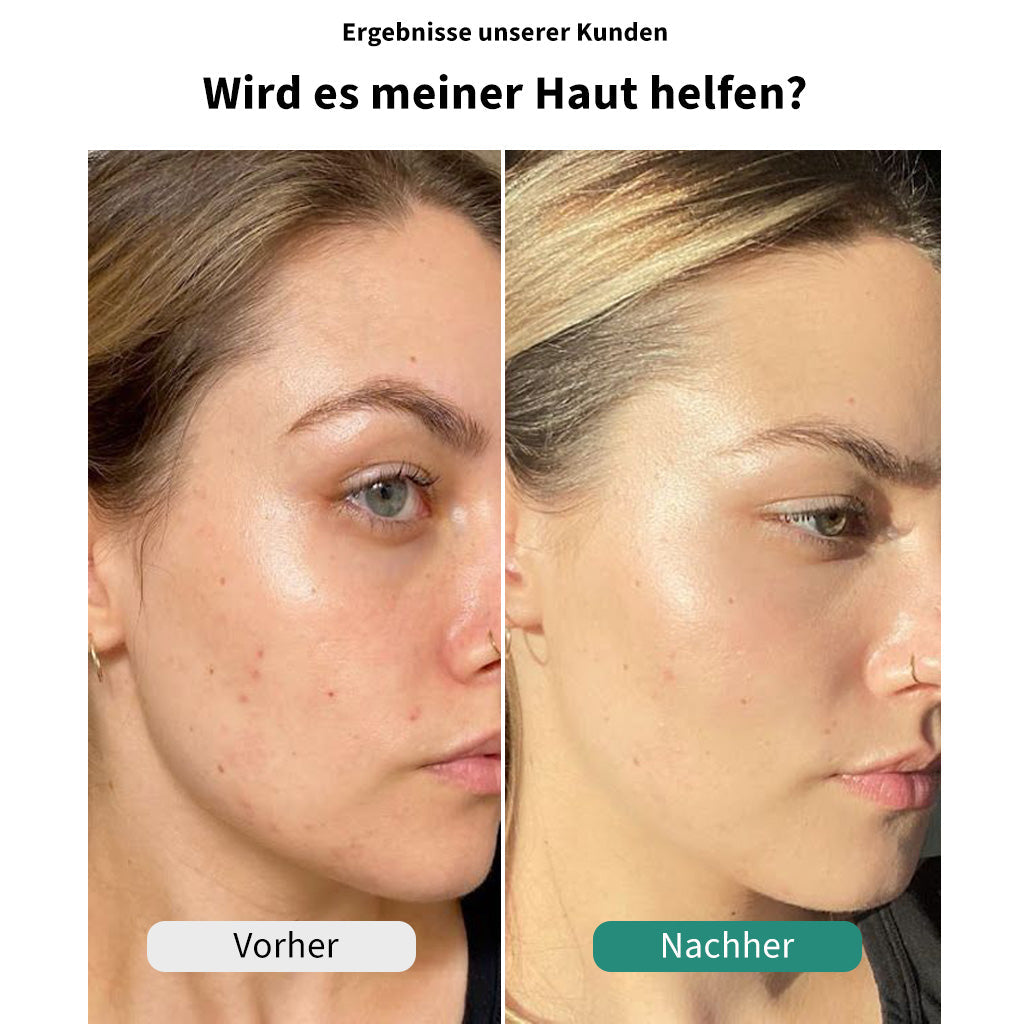 ReinDusche™