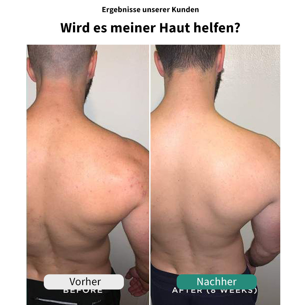 ReinDusche™