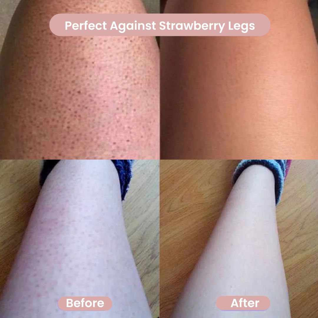Livia™ – Women’s Body Shaver