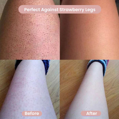 Livia™ – Women’s Body Shaver