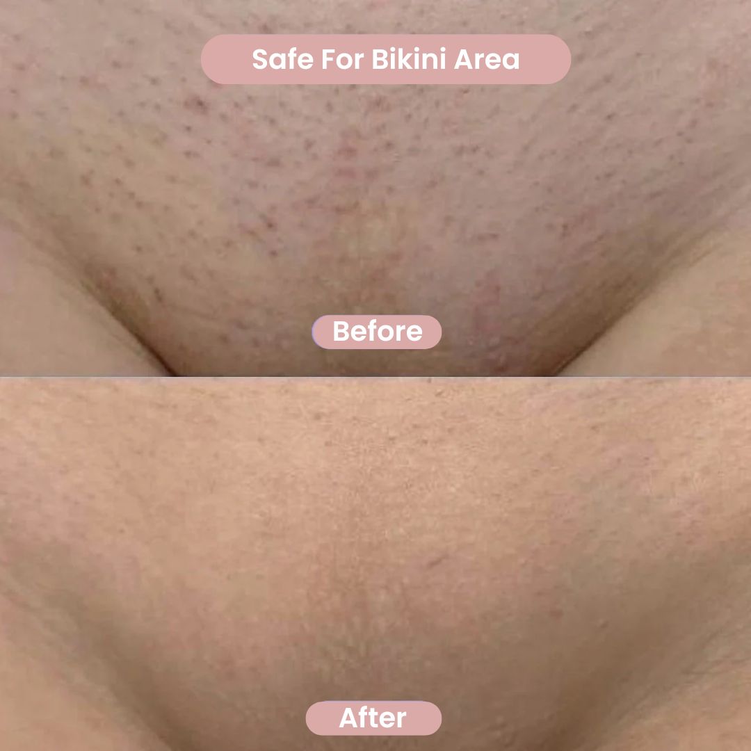 Livia™ – Women’s Body Shaver